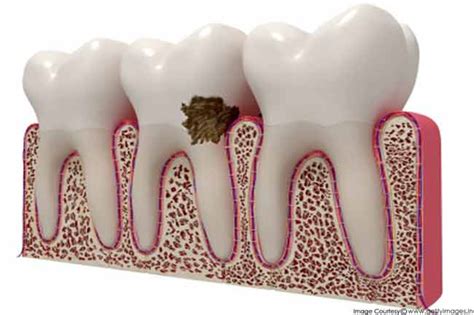 common   dental problem reasons  teeth
