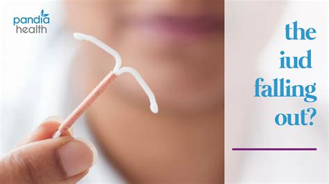 can an iud fall out why and what to do pandia health