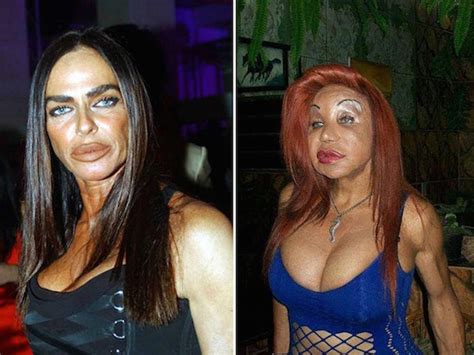 plastic surgery gone wrong sick chirpse