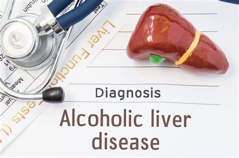 Signs Of Liver Disease Midwood Addiction Treatment