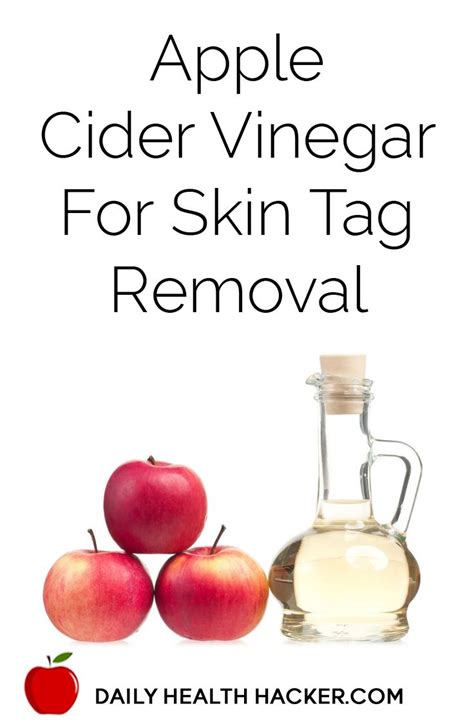 apple cider vinegar for skin tag removal apple cider vinegar for skin
