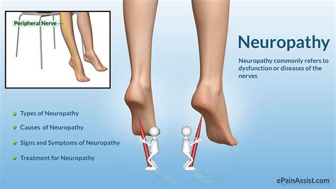 neuropathy classification types causes risk factors