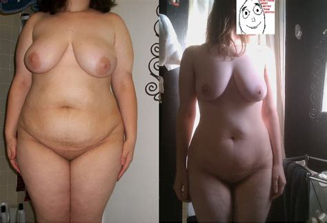 Hard Mode Naked Before And After Weight Loss Pics Really Nsfw Imgur