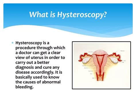 Ppt What Is Hysteroscopy Powerpoint Presentation Free Download Id