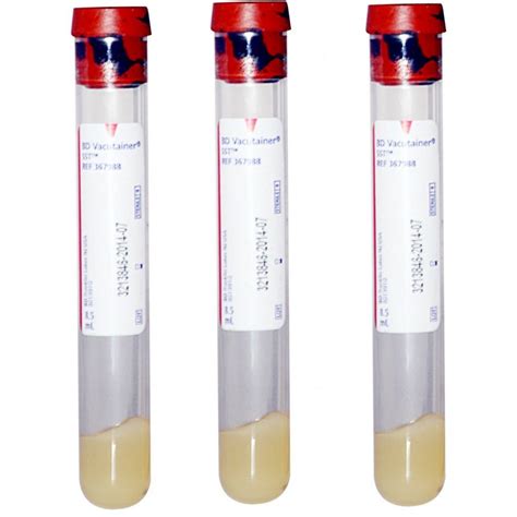 vacutainer tube sst ml draw xmm st  bx medical supply usa