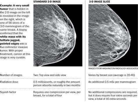 Another Way To Look At Breasts The Washington Post