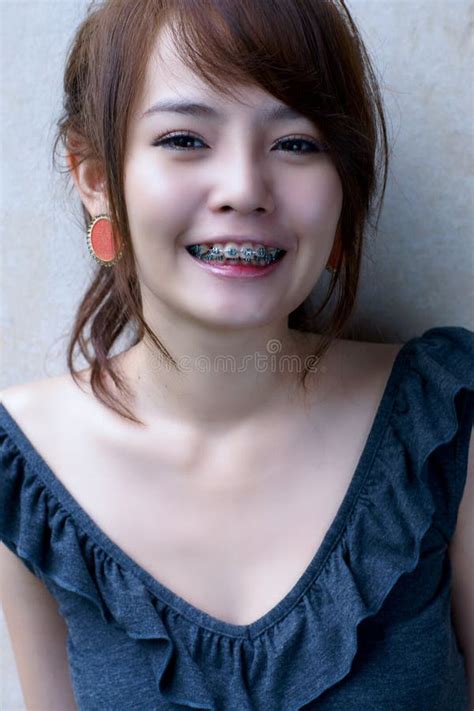 Asian Braces Girl Smile Stock Image Image 23057071