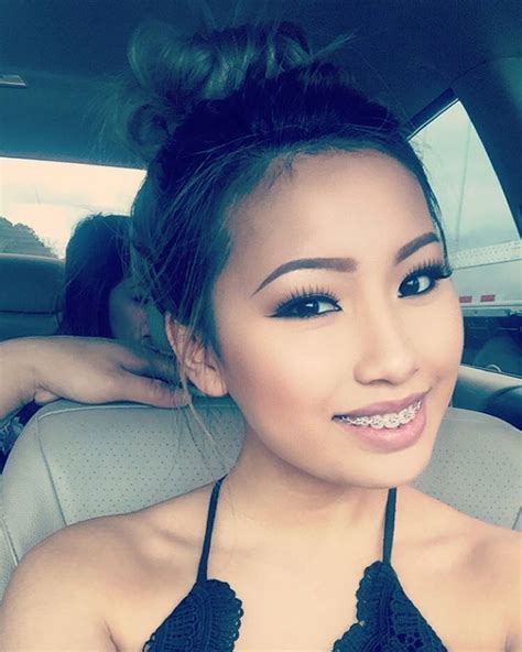 Cute Asian Girl With Braces – Telegraph