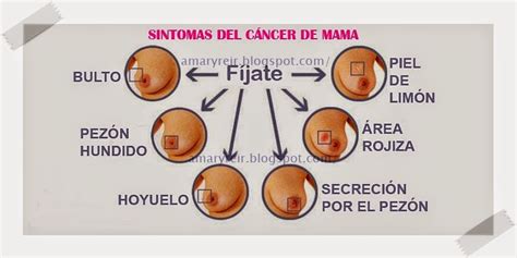 cancer de mama sintomas iniciales seo positivo