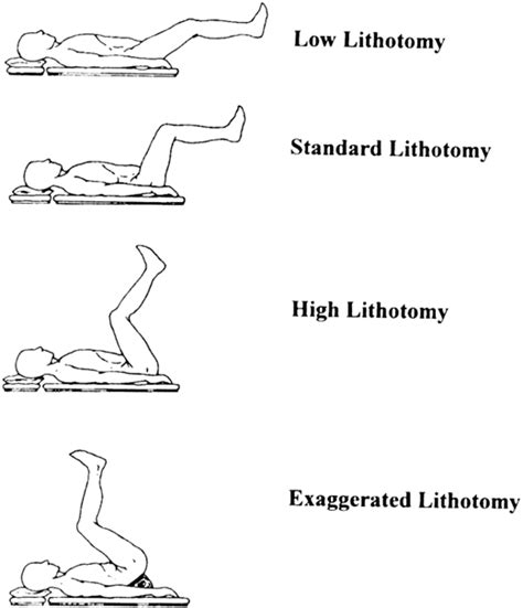 effect   lithotomy positions   extremity blood pressure