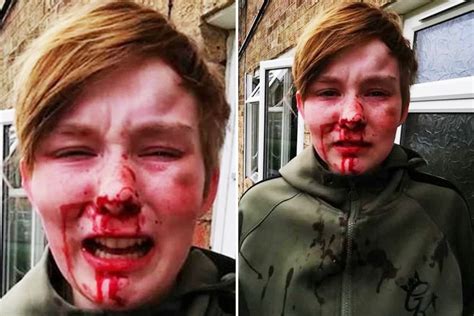 teen girl ‘beaten black and blue and branded ‘f
