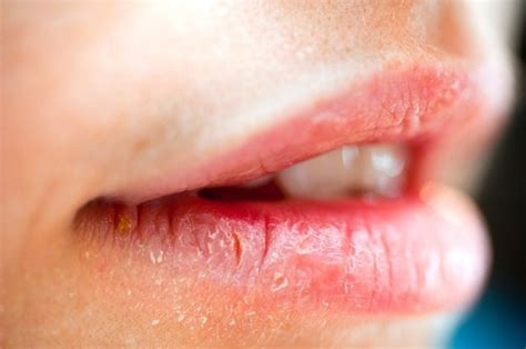 8 Warning Signs Your Lips Are Sending You