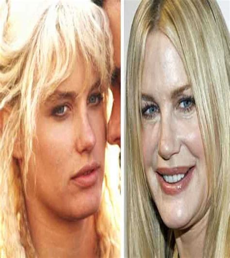 60 worst cases of celebrity plastic surgery gone wrong
