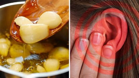 How To Make Garlic Oil Ear Drops For Ear Aches And Ear Infections