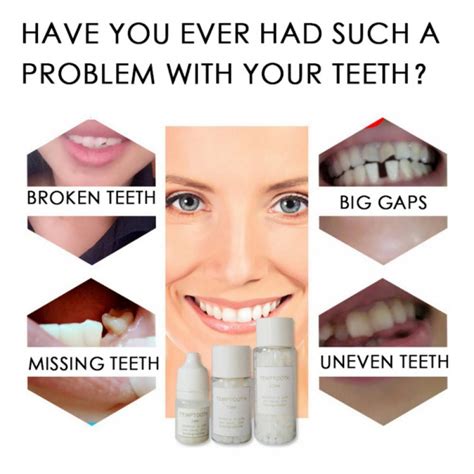 Savlot Temporary Missing Tooth Repair Kit Teeth And Gaps Falseteeth