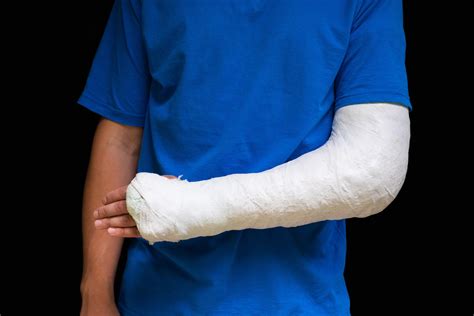 black boys arm broken  racist attack