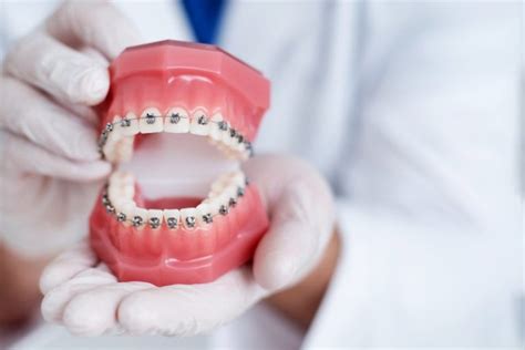 Orthodontist Holding Up Model Of Teeth With Braces Wigal