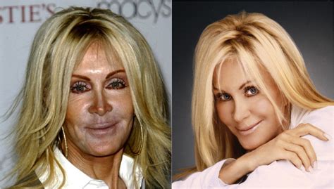 celebrity plastic surgery is it just bad photos