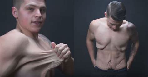 This Video Of A Guy With Loose Skin After Weight Loss Is