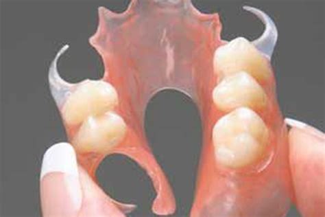 dentures partials intelligent touch dental laboratory