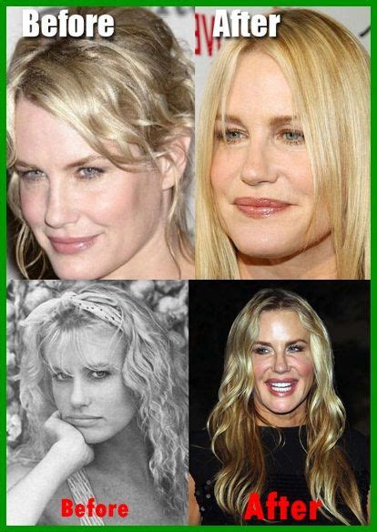 daryl hannah botox plastic surgery disaster pictures