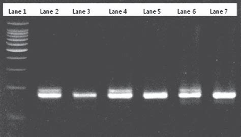 a gel electrophoresis of sex specific pcr products for sex