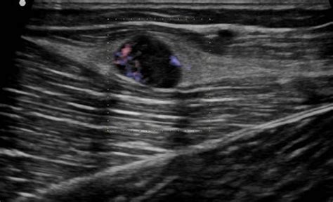 Musculoskeletal Bone Muscle Nerves And Other Soft