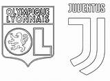 Juventus Colorare Coloriage Ronaldo Ligue Uefa Olympique Juve Disegno Lyonnais Coloriages Ronde Malvorlagen Bonjourlesenfants Turin Morningkids Maillot 2031 sketch template