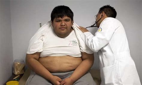 Fat City The Obesity Crisis That Threatens To Overwhelm Mexicos