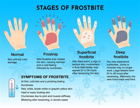 frostbite symptoms  cold           fast   occur