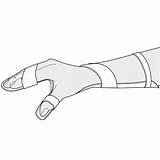 Splint Hand Resting sketch template