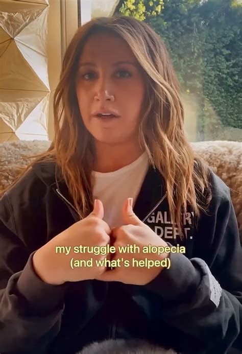 Ashley Tisdale Reveals Alopecia Struggles Connected To Stress Overload