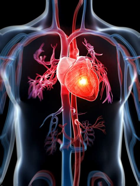 veda  roku  srdce po infarkte maju vyliecit cievotvorne bunky clovek veda  technika