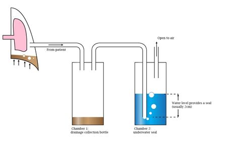 underwater seal chest drain system deranged physiology