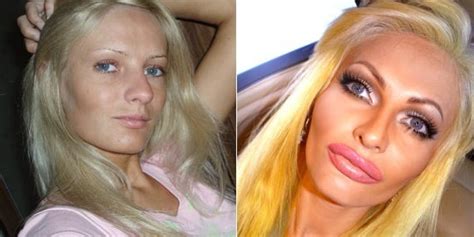 Model Spends Thousands On Plastic Surgery To Look Like A