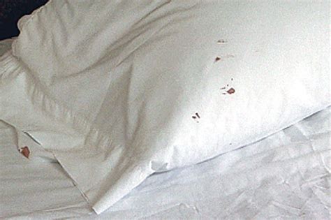 Can Bed Bugs Live Inside Pillows Bed Pillow