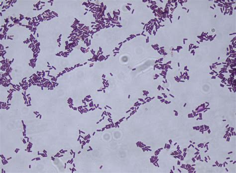 Bacillus Subtilis Bacilli In Chains Gram