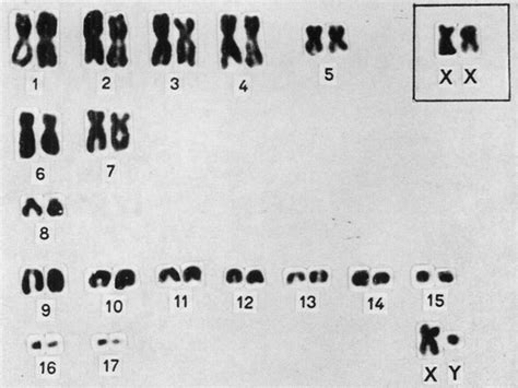 male karyotype of pipistrellus affinis xx sex chromosomes from a