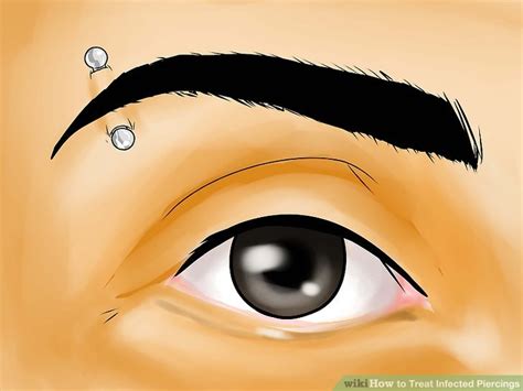 treat infected piercings  steps  pictures