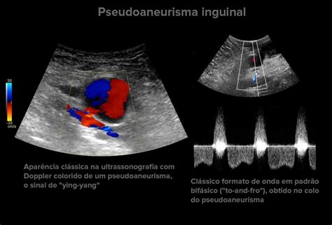 diagnosticos ultrassonograficos  voce nao pode deixar de fazer