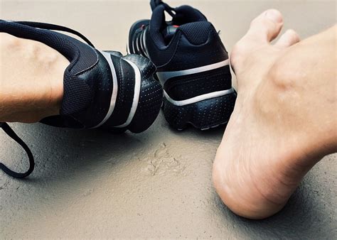 Smelly Feet—more Than Just Embarrassing Orthopaedic Foot And Ankle