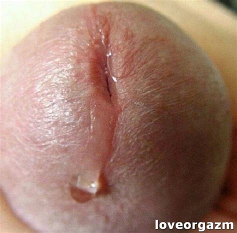 female premature ejaculation lingerie free sex