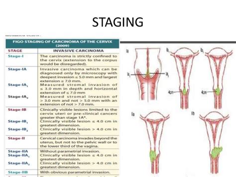 Cervical Cancer