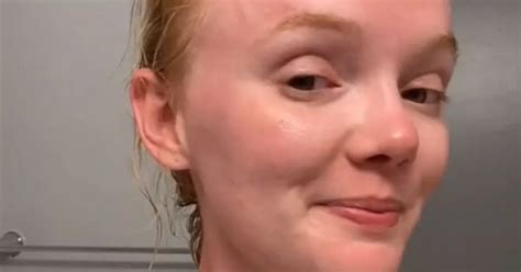 redhead gets burnt after less than 30 minutes in the sun in ultimate
