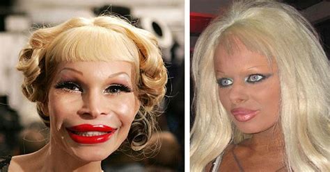 17 pics of plastic surgery gone wrong creepy gallery