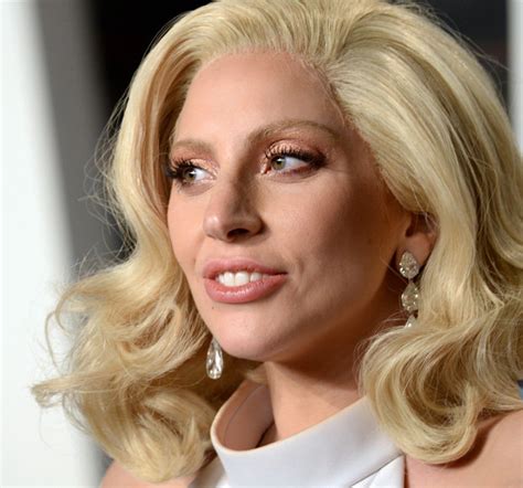 Lady Gaga Face Lift Plastic Surgeon Gives Verdict On