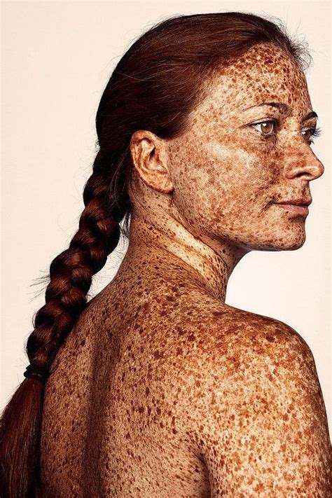 The Fabulously Freckled Get Their Close Up In Photo Project Huffpost