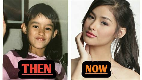 10 Famous Filipino Celebrities Who Looks Before And After