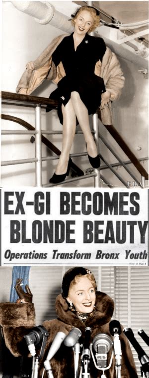 Ex Gi Becomes Blonde Beauty Operations Transform Bronx Youth Alexander