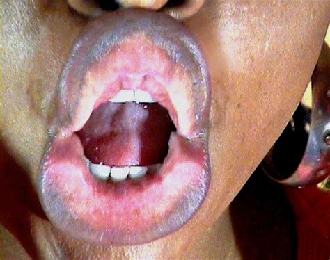 ebony mouth fetish sucking slurping
